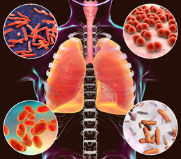 Strategies to Improve Diagnosis and Treatment of Nontuberculous Mycobacterial Lung Disease